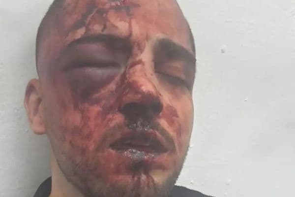 "البلاد | تصعيد غير مسبوق احتجاجًا على ما جرى مع المحامي صالح خليل نعمة"